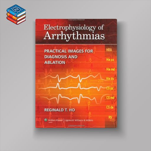 Electrophysiology of Arrhythmias: Practical Images for Diagnosis and Ablation (EPUB)