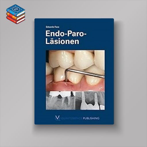 Endo-Paro-Läsionen (German Edition) (EPUB)