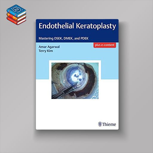 Endothelial Keratoplasty: Mastering DSEK