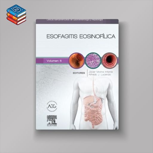 Esofagitis eosinofílica: Clínicas Iberoamericanas de Gastroenterología y Hepatología vol. 5