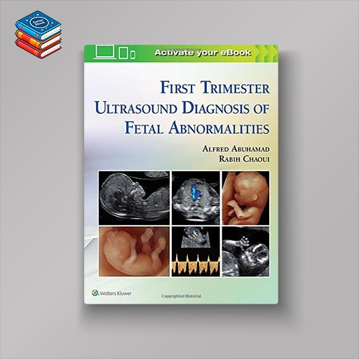 First Trimester Ultrasound Diagnosis of Fetal Abnormalities (EPUB)