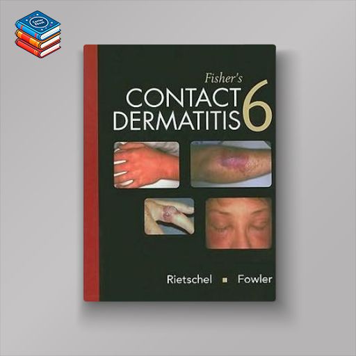 Fisher’s Contact Dermatitis