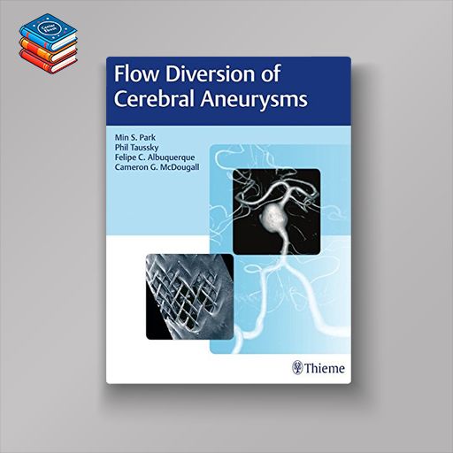 Flow Diversion of Cerebral Aneurysms (EPUB)