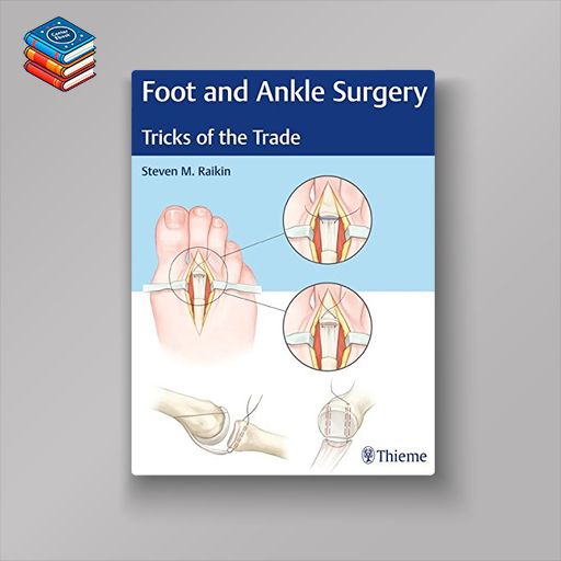 Foot and Ankle Surgery: Tricks of the Trade (EPUB)