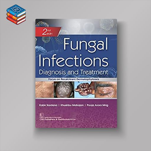 Fungal Infections Diagnosis and Treatment