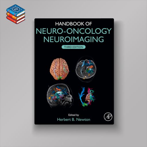 Handbook of Neuro-Oncology Neuroimaging