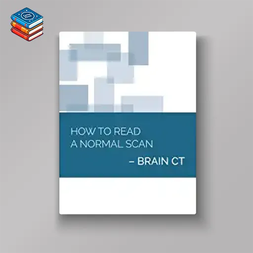 How to Read a Normal Scan : Brain CT (High Quality Image PDF)