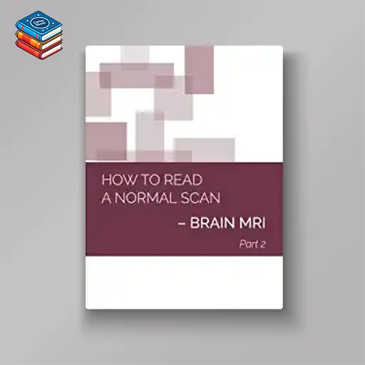 How to Read a Normal Scan: BRAIN MRI PART 2 (High Quality Image PDF)