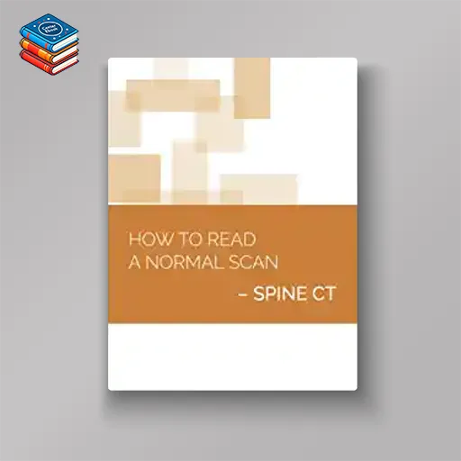 How to Read a Normal Scan : SPINE CT (High Quality Image PDF)