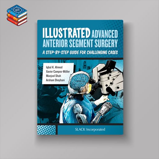 Illustrated Advanced Anterior Segment Surgery (EPUB)