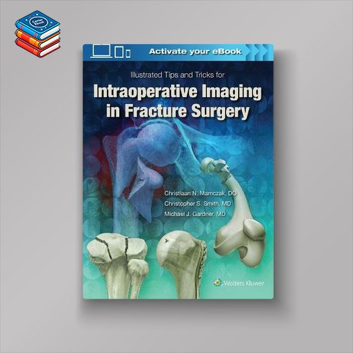 Illustrated Tips and Tricks for Intraoperative Imaging in Fracture Surgery (EPUB)