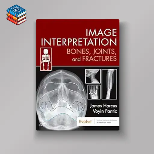 Image Interpretation: Bones