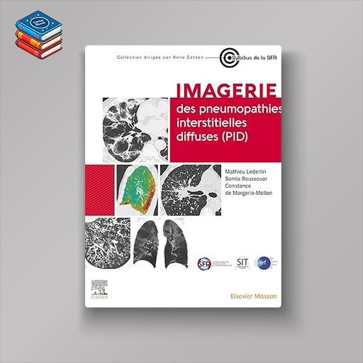 Imagerie des pneumopathies interstitielles diffuses (PID) (French Edition) (Original PDF from Publisher)