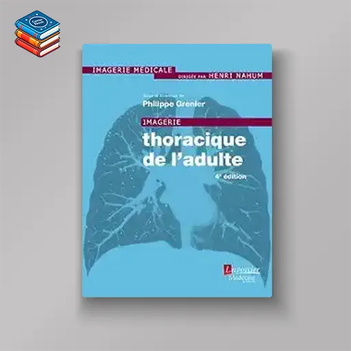 Imagerie Thoracique De L’adulte (French Edition)