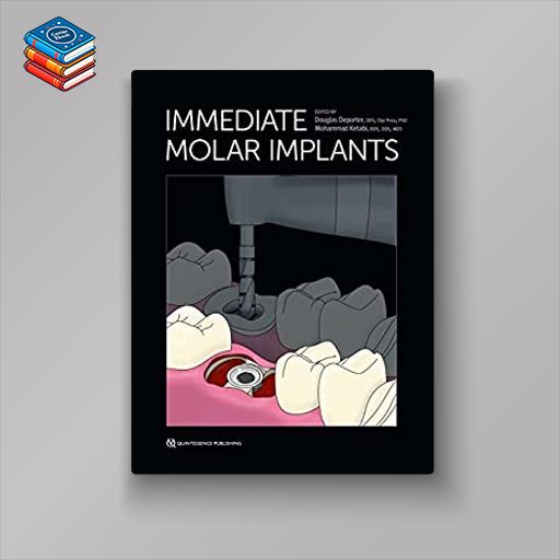 Immediate Molar Implants (Original PDF from Publisher)