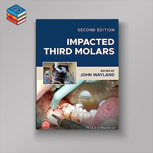 Impacted Third Molars