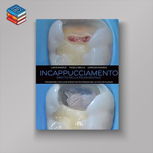 Incappucciamento diretto della polpa dentale: Procedure e tecniche operative per preservare la vitalità pulpare (EPUB)