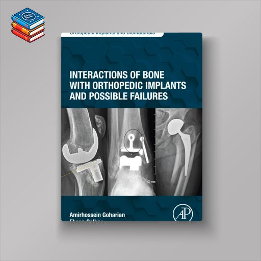 Interactions of Bone with Orthopedic Implants and Possible Failures (EPUB)