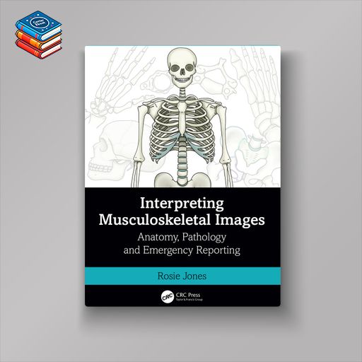 Interpreting Musculoskeletal Images (EPUB)