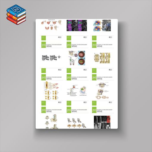 Journal of Neurosurgery: Spine 2022 Full Archives (True PDF)