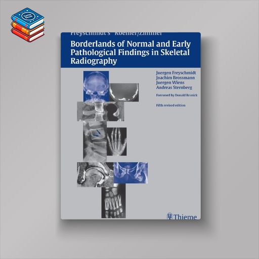 Koehler/Zimmer’s Borderlands of Normal and Early Pathological Findings in Skeletal Radiography