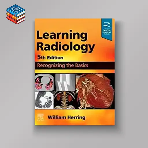 Learning Radiology: Recognizing the Basics