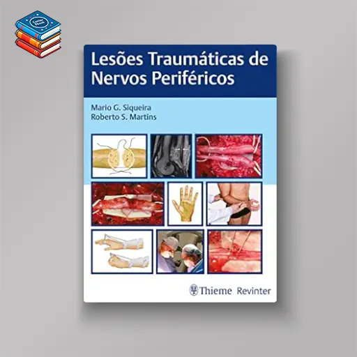 Lesões Traumáticas de Nervos Periféricos (Portuguese Edition) (EPUB)