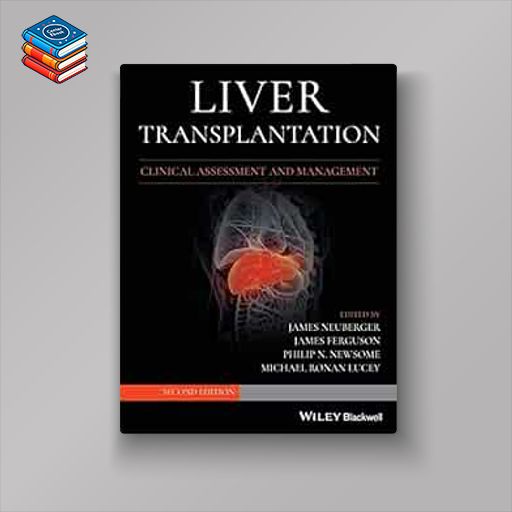 Liver Transplantation: Clinical Assessment and Management