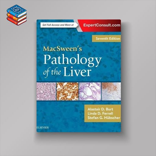 MacSween’s Pathology of the Liver