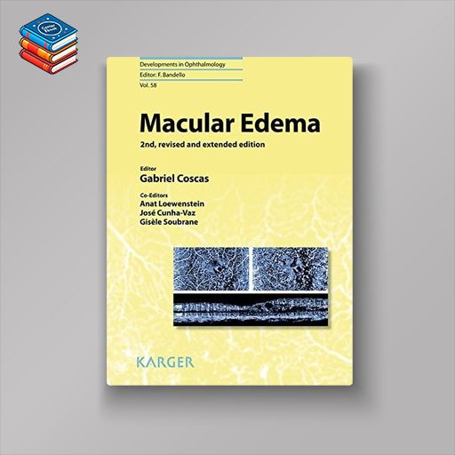 Macular Edema (Developments in Ophthalmology