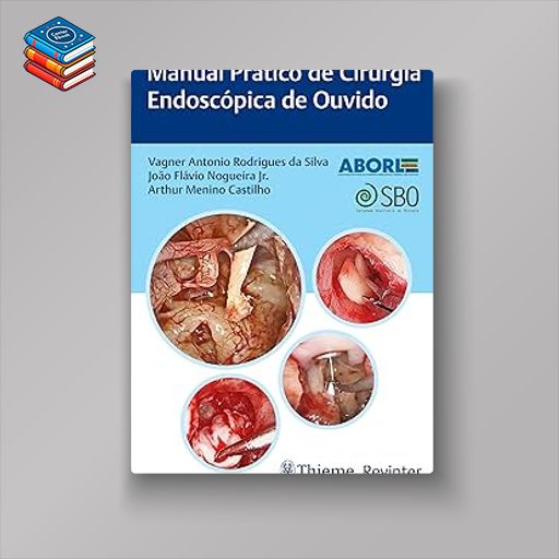 Manual Prático de Cirurgia Endoscópica de Ouvido (Portuguese Edition) (EPUB)