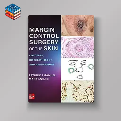 Margin Control Surgery of the Skin: Concepts