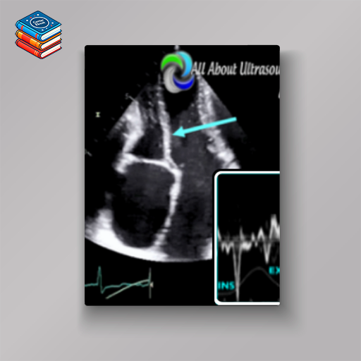 Mastering Constrictive Pericarditis – AllAboutUltrasound 2022 (Complete HTML)