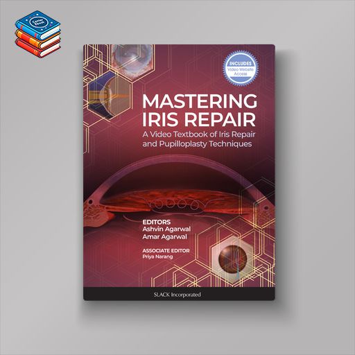 Mastering Iris Repair: A Video Textbook of Iris Repair and Pupilloplasty Techniques (EPUB)