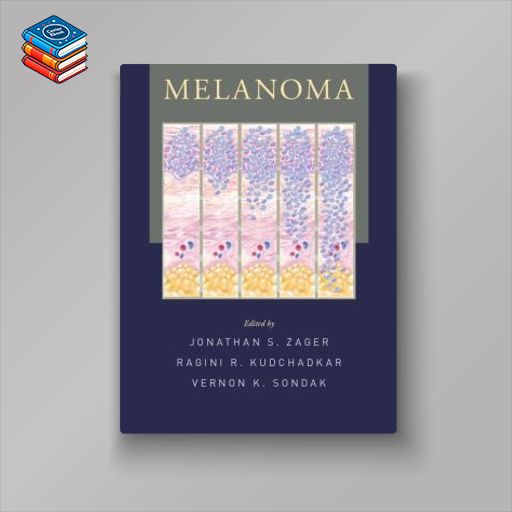 Melanoma