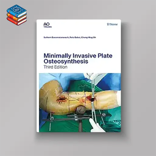 Minimally Invasive Plate Osteosynthesis (AO-Publishing)