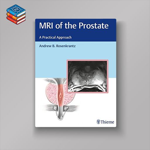 MRI of the Prostate: A Practical Approach (PDF)