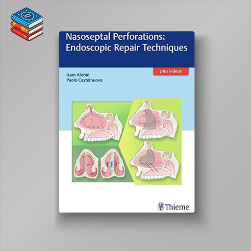 Nasoseptal Perforations: Endoscopic Repair Techniques (EPUB)