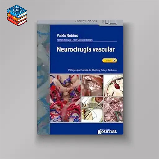 Neurocirugía Vascular (EPUB + Videos)