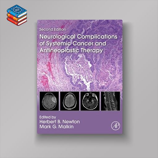 Neurological Complications of Systemic Cancer and Antineoplastic Therapy