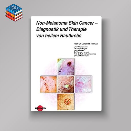 Non-Melanoma Skin Cancer – Diagnostik und Therapie von hellem Hautkrebs (UNI-MED Science) (German Edition) (Original PDF from Publisher)