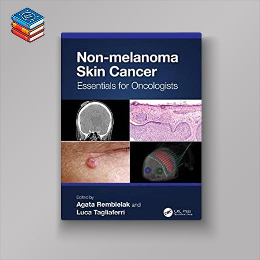 Non-melanoma Skin Cancer: Essentials for Oncologists (Original PDF from Publisher)