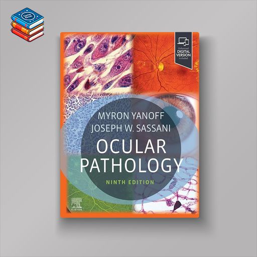 Ocular Pathology