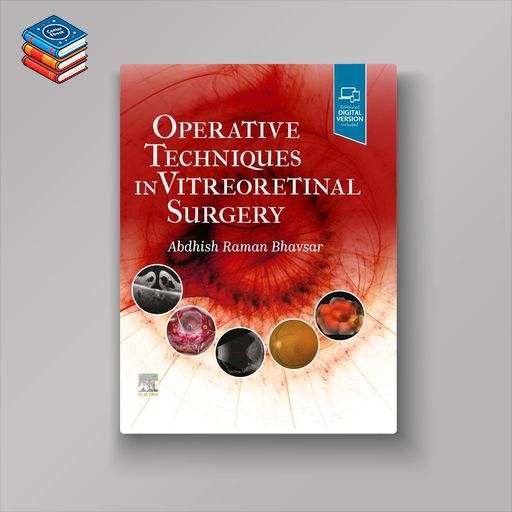 Operative Techniques in Vitreoretinal Surgery (EPUB)