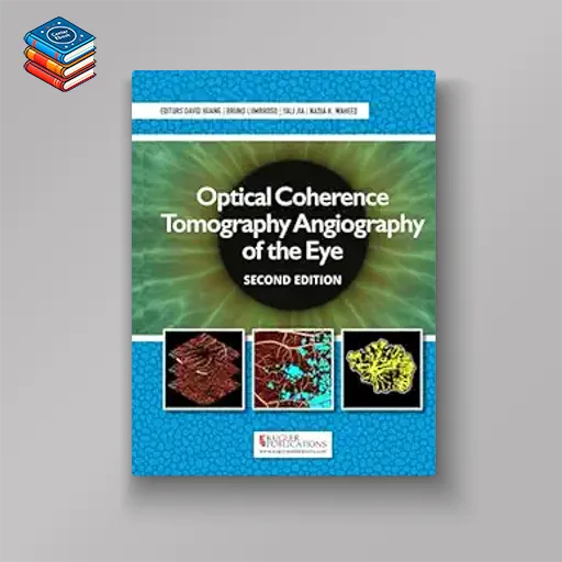 Optical Coherence Tomography Angiography of the Eye