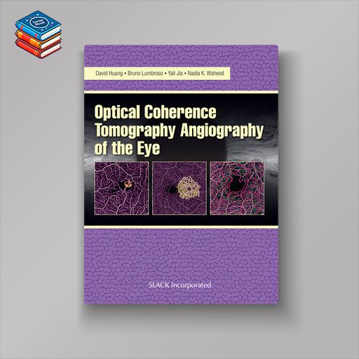 Optical Coherence Tomography Angiography of the Eye (EPUB)