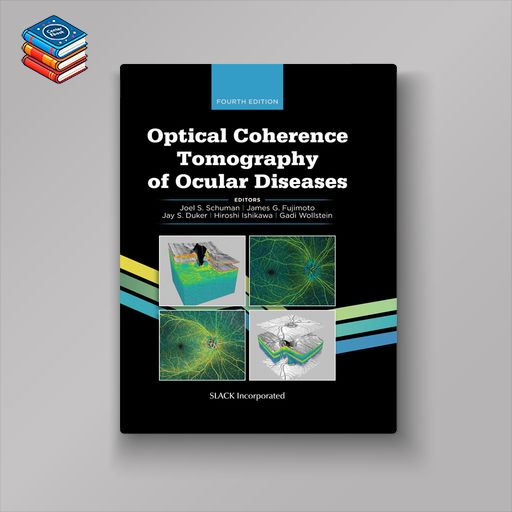 Optical Coherence Tomography of Ocular Diseases