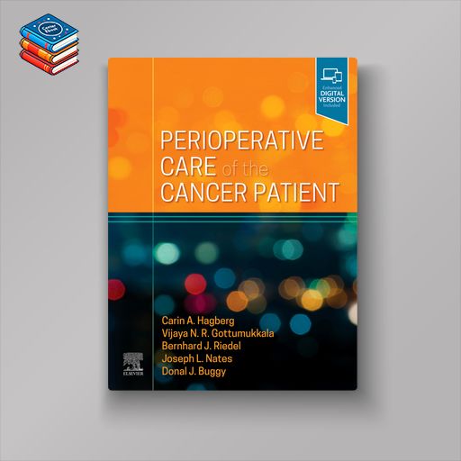 Perioperative Care of the Cancer Patient (EPUB)