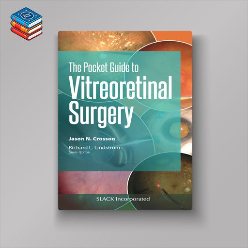 Pocket Guide to Vitreoretinal Surgery (EPUB)