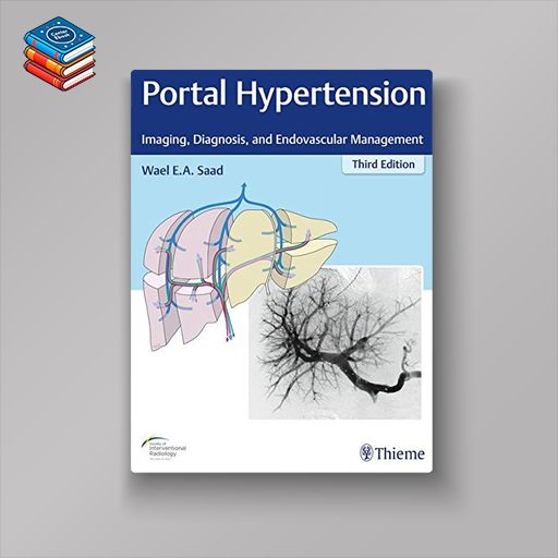 Portal Hypertension: Imaging